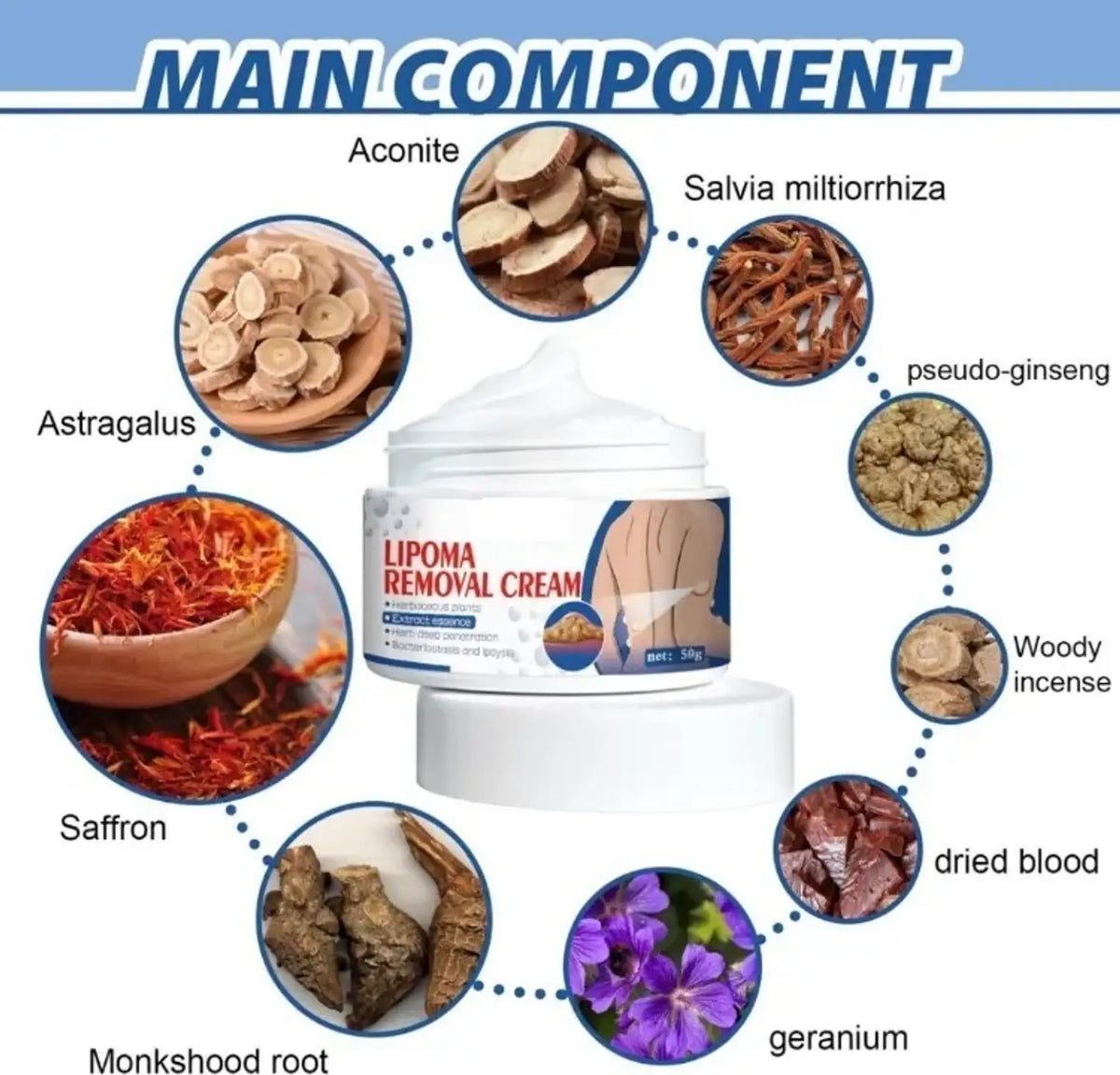 Lipoma Removal Cream Herbal Treatment For Safe And Effective Lipoma Reduction, 50G